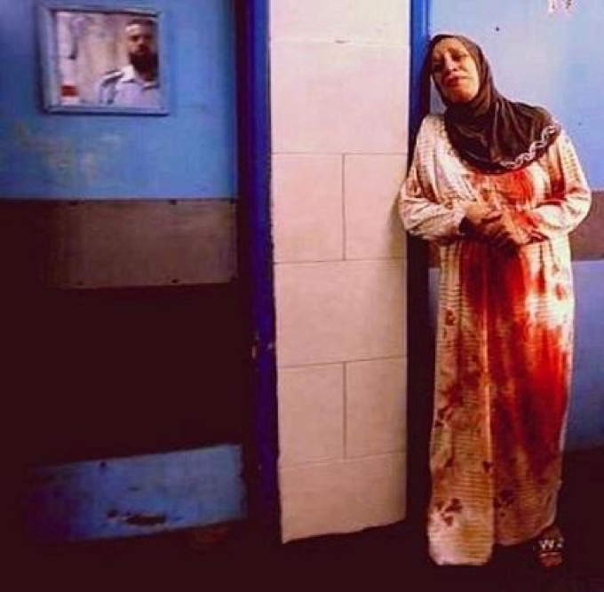 woman-w-bloody-clothes