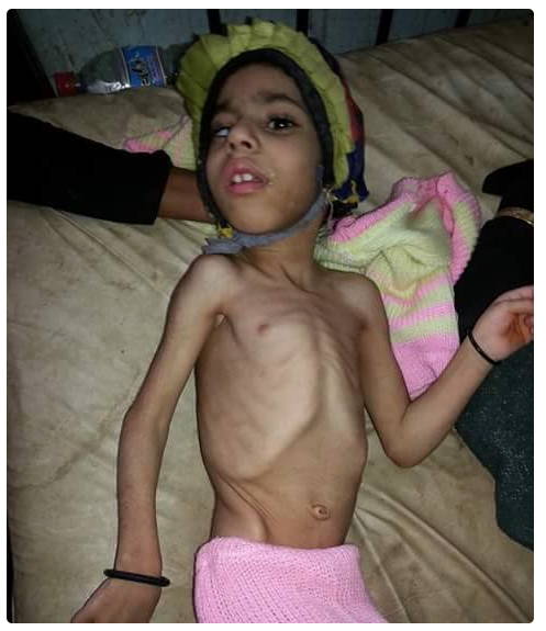Saud Bombing Yemen