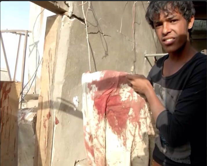 Saud Bombing Yemen